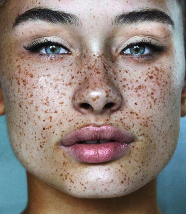 What Kind of Pigmentation Do You Have?