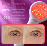 LED Red Light for Wrinkles
